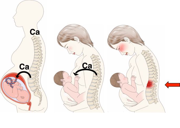 vì sao sau sinh mẹ thường bị đau lưng, mỏi vai