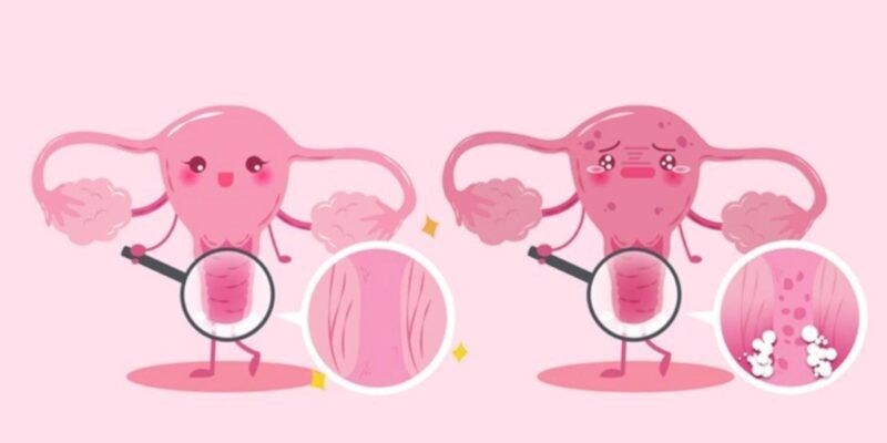 Bí quyết đối mặt và bảo vệ sức khoẻ cô bé