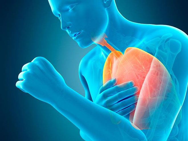 Viêm phổi dị ứng, khó thở.
