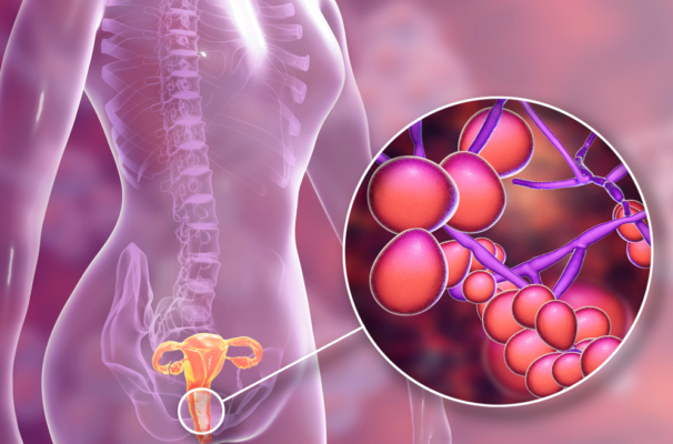 Nấm Candida là một trong những nguyên nhân chính gây viêm loét vùng kín