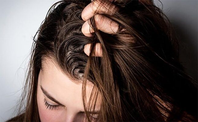 Nguyên nhân gây tình trạng da đầu bị khô