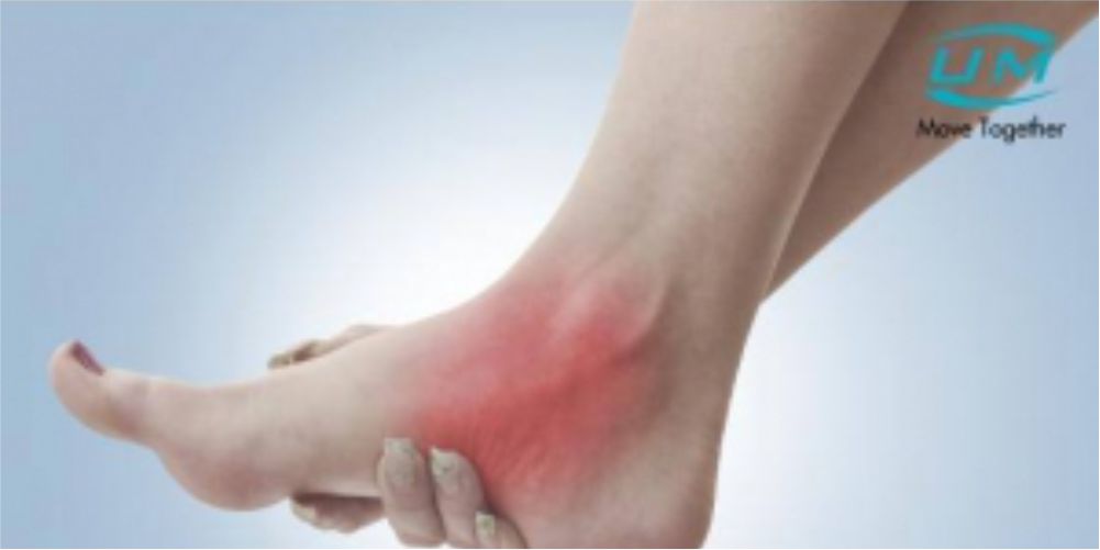 [Infographic] 5 dấu hiệu bị bong gân dễ nhận biết và cách phòng ngừa