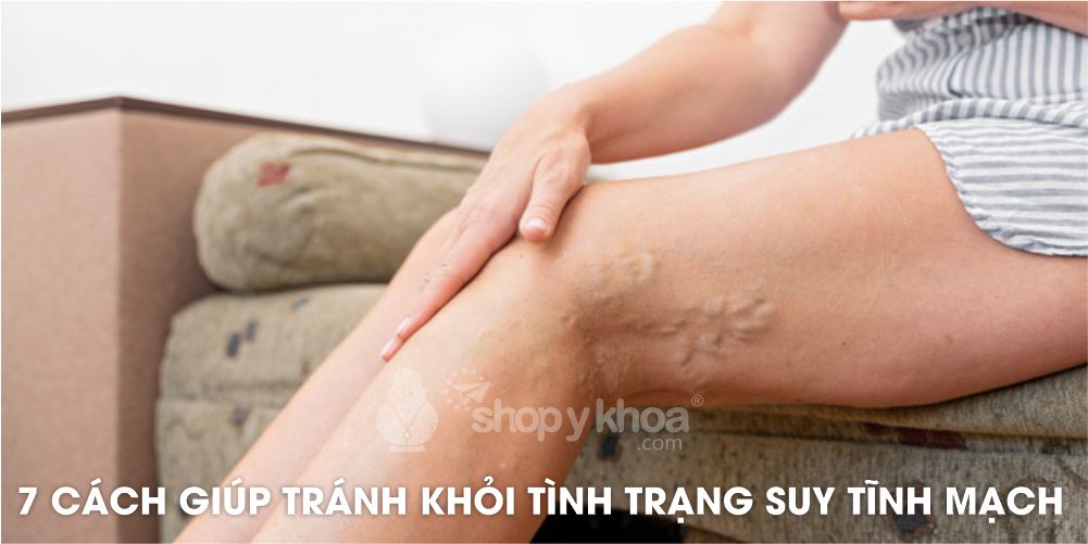 7 CÁCH GIÚP TRÁNH KHỎI TÌNH TRẠNG SUY TĨNH MẠCH