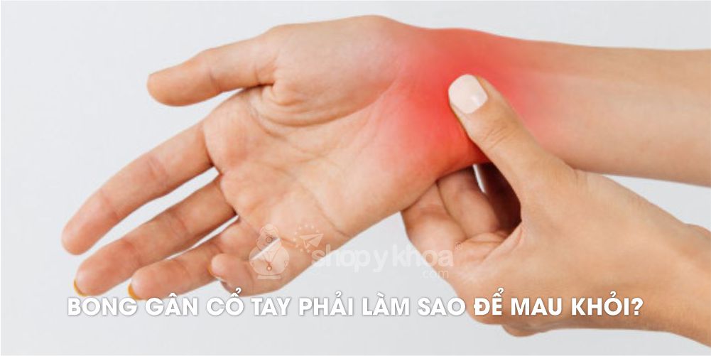 Bong gân cổ tay phải làm sao để mau khỏi?
