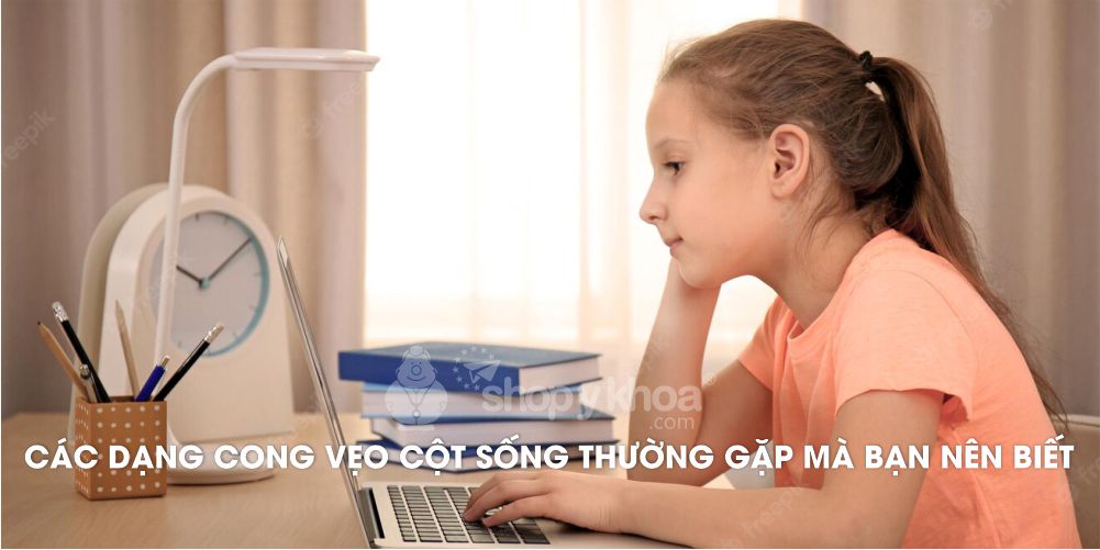 Các dạng cong vẹo cột sống thường gặp mà bạn nên biết