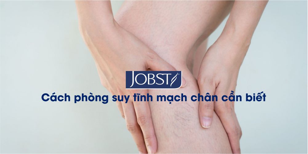Cách phòng suy tĩnh mạch chân cần biết