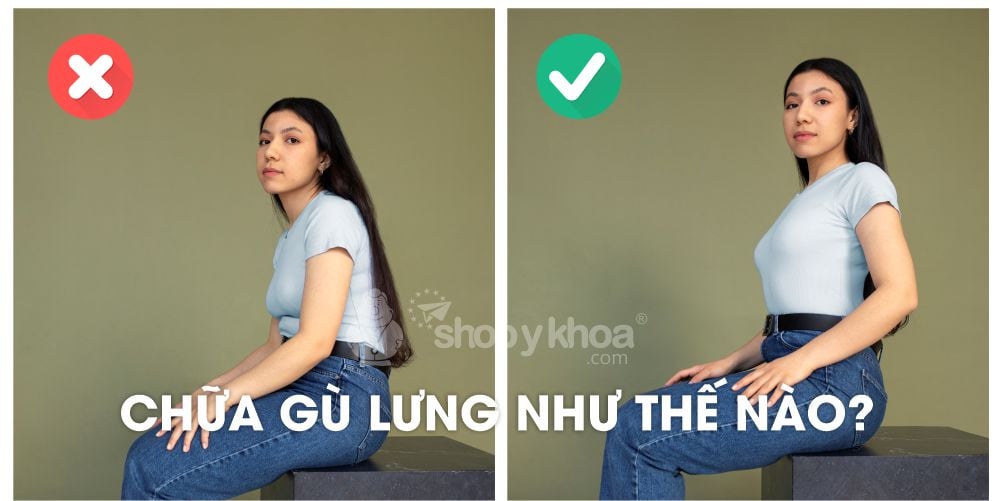 CHỮA GÙ LƯNG NHƯ THẾ NÀO?