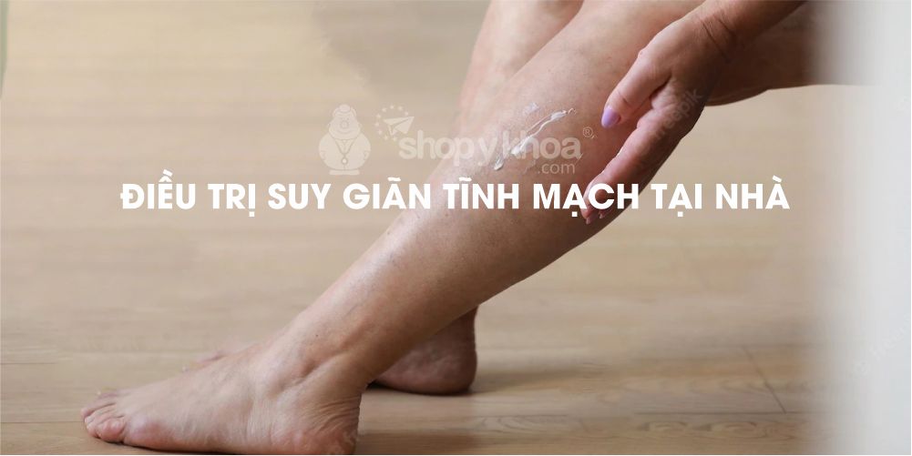 ĐIỀU TRỊ SUY GIÃN TĨNH MẠCH TẠI NHÀ