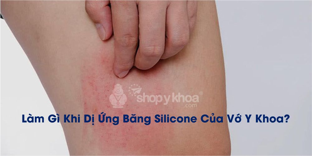 Làm Gì Khi Dị Ứng Băng Silicone Của Vớ Y Khoa?