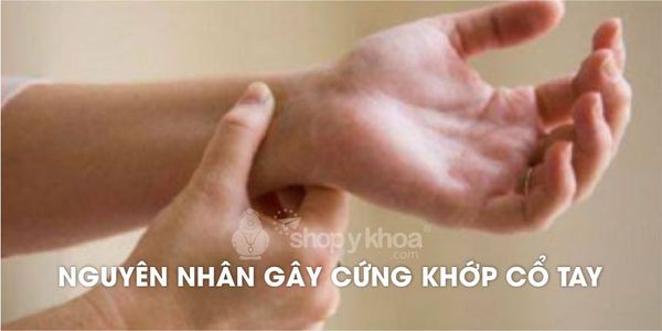 Nguyên nhân gây cứng khớp cổ tay