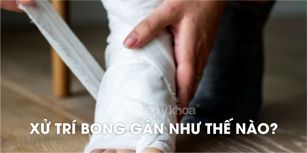 XỬ TRÍ BONG GÂN NHƯ THẾ NÀO?
