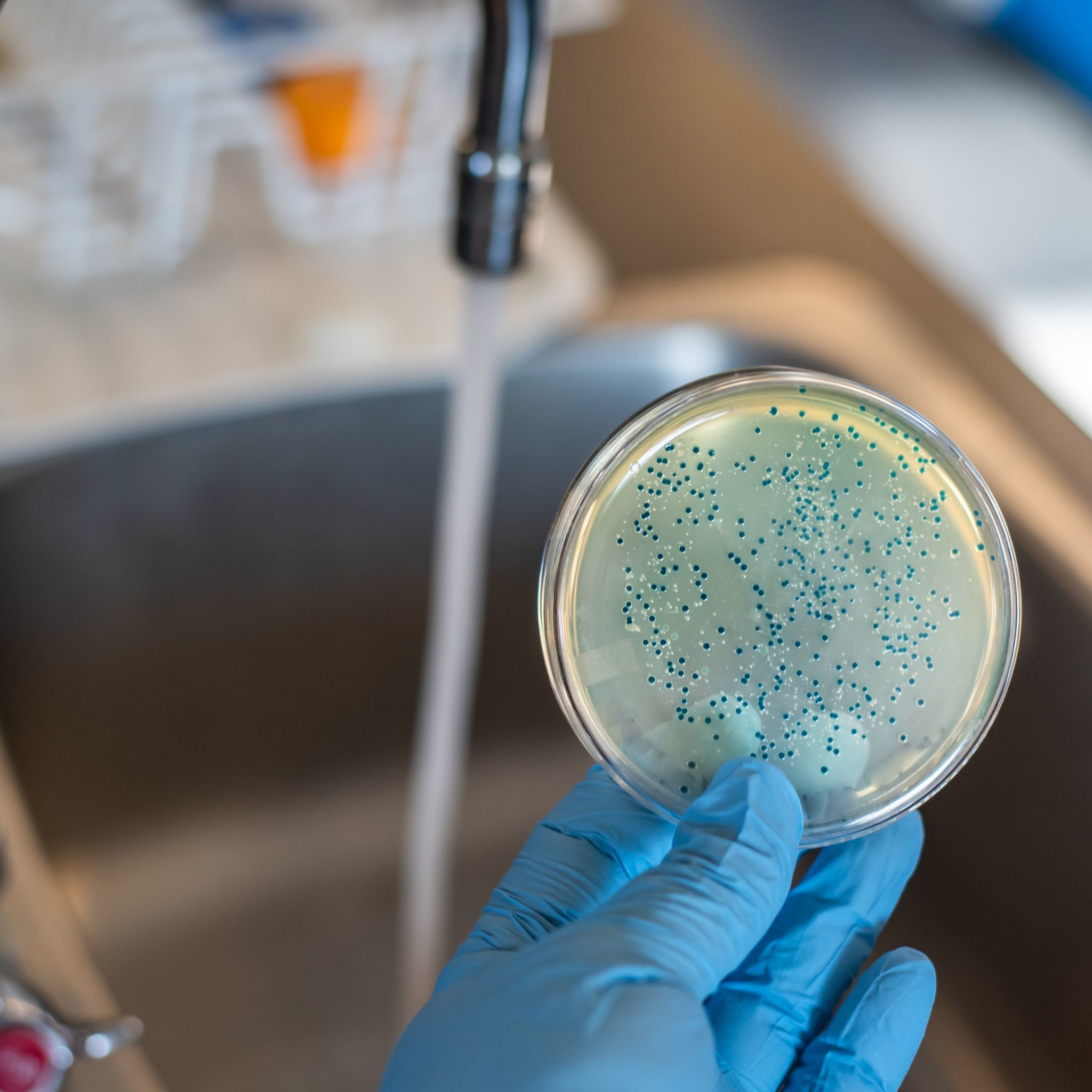 Nhiễm Khuẩn E. coli