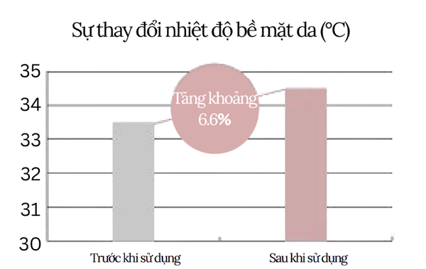 uu-diem-voi-sen-tuya-2