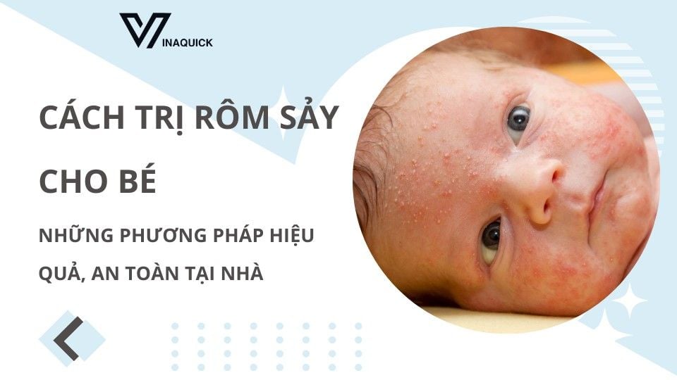 Cách trị rôm sảy cho bé - Những phương pháp hiệu quả, an toàn tại nhà