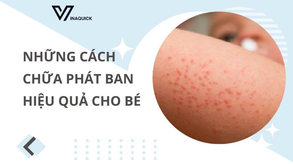 Những cách chữa phát ban hiệu quả cho bé