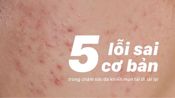 5 lỗi sai cơ bản trong chăm sóc da khiến mụn tái đi tái lại