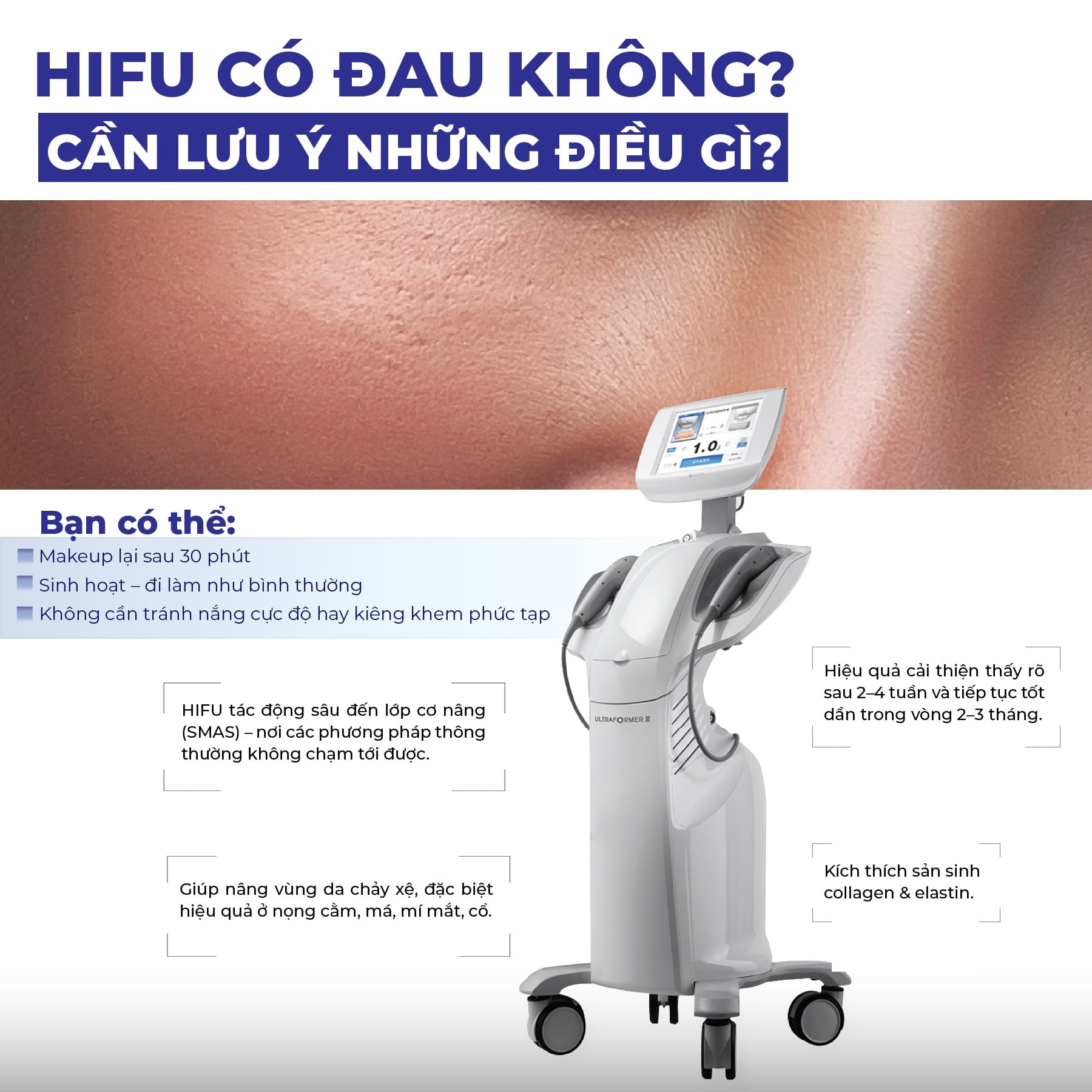 HIFU có đau không? Cần lưu ý những điều gì?