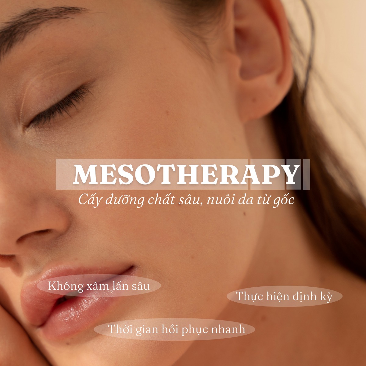 Mesotherapy – Cấy dưỡng chất sâu, nuôi da từ gốc